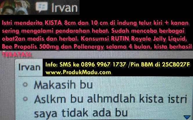 testimoni kista 8+10 cm photo Istri Kista 810cm Irvan.jpg