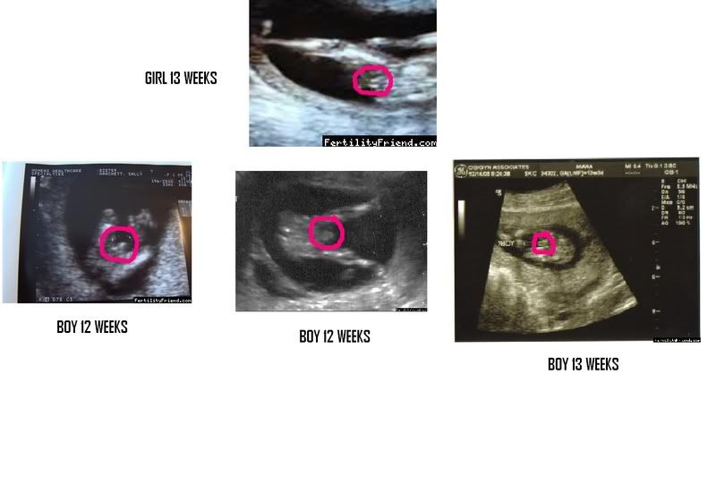 Can pregnancy dating scans be wrong-in-Motueka
