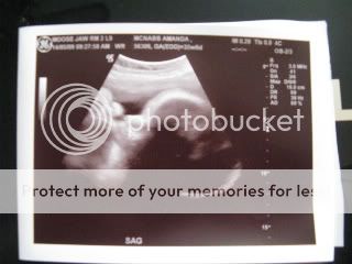 4d ultrasound pictures at 36 weeks